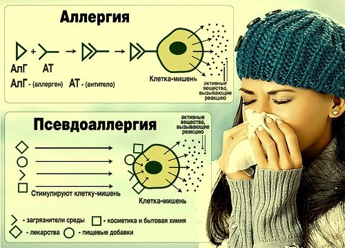 allergiya-i-psevdo-2825268